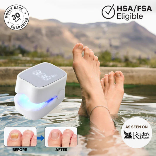 VeloriaNail Pro™ - Nail Fungus Laser Device